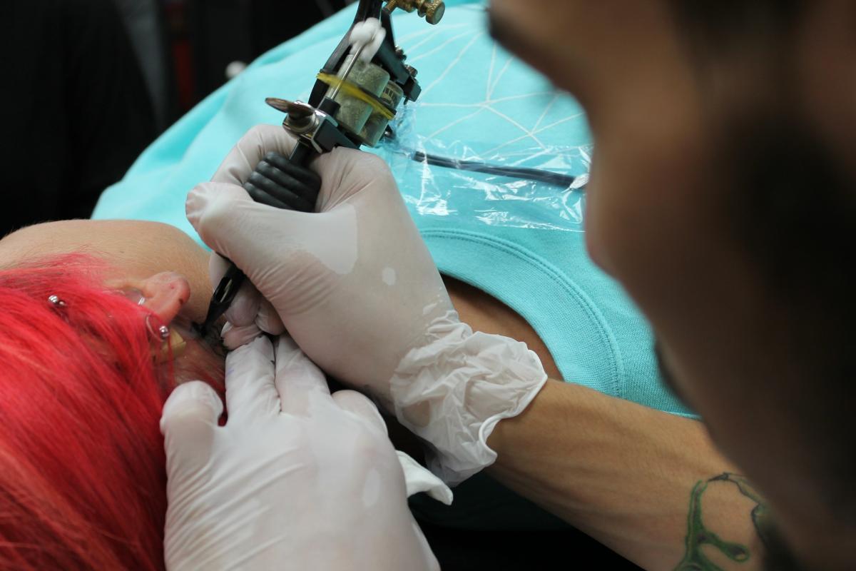 Czy laserowe usuwanie tatuażu jest skuteczne? 